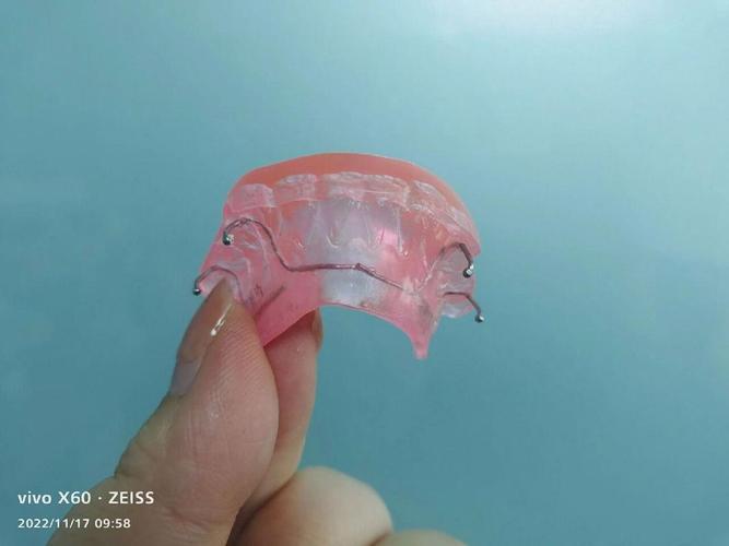 矫正牙齿的合垫-图2