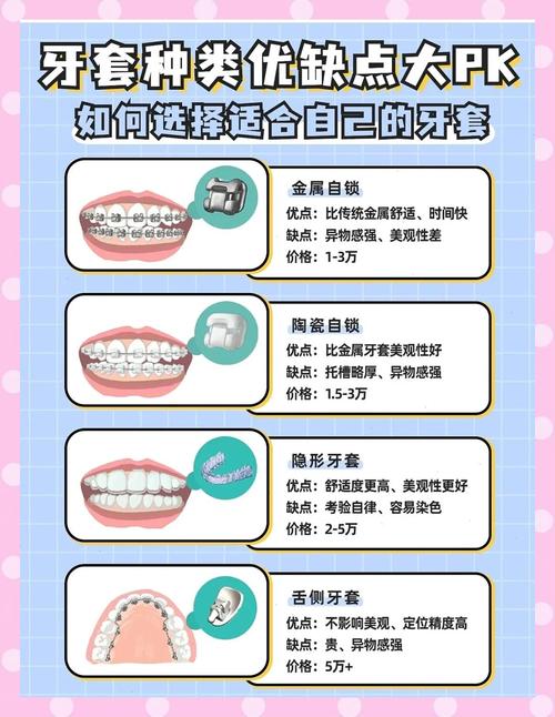 牙齿矫正到底该怎么办？有哪些方法和步骤需要了解？-图1