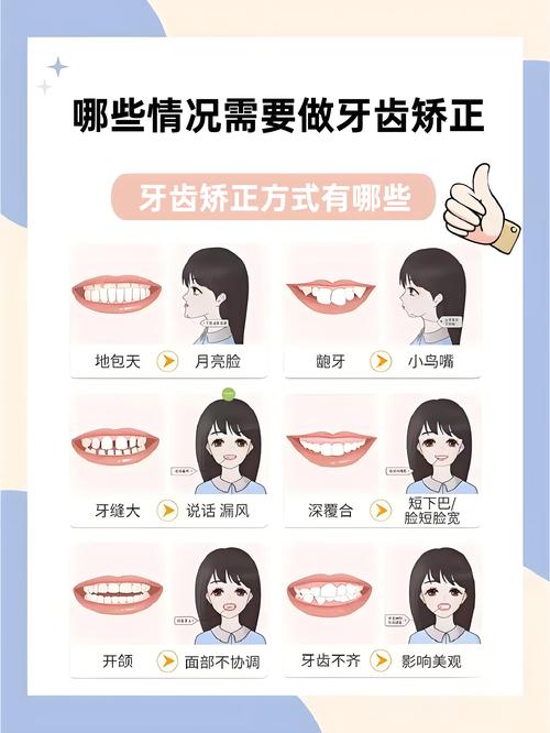 牙齿矫正到底该怎么办？有哪些方法和步骤需要了解？-图2