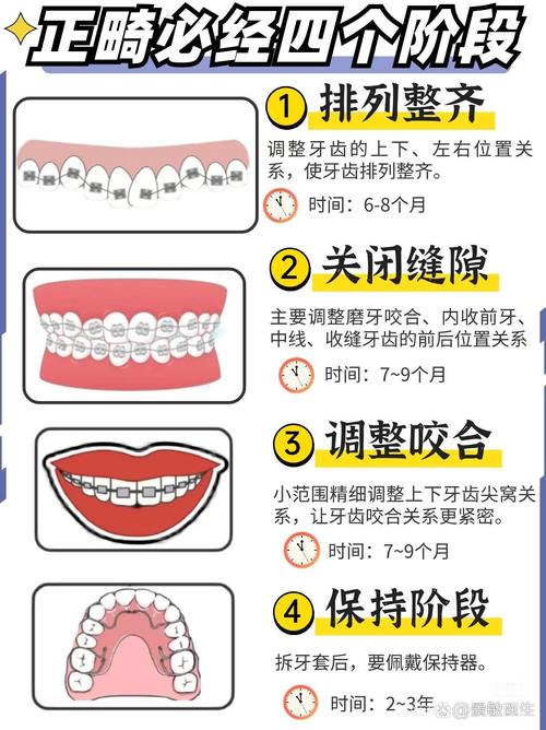 牙齿矫正有多久-图1 牙齿矫正有多久-图1