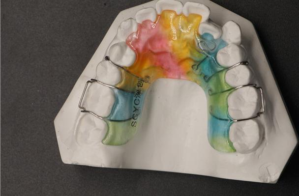 矫正牙齿上弹簧，究竟有何作用？-图3