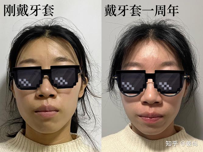 成都 牙齿矫正-图3