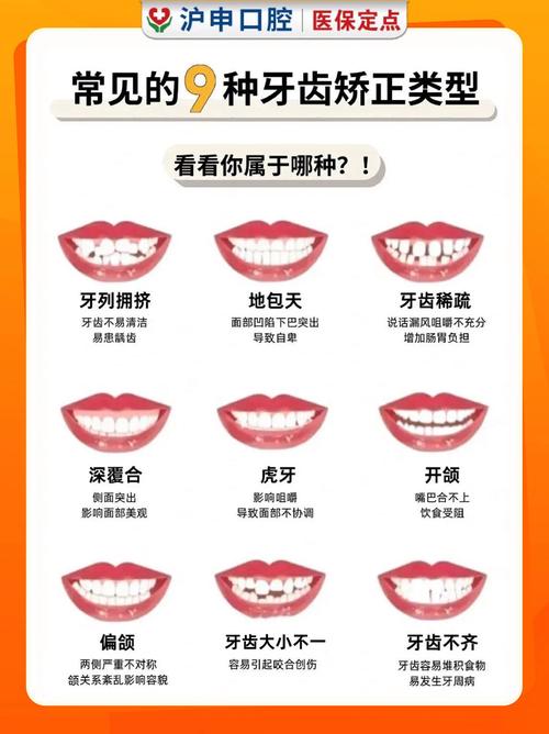 牙齿矫正有哪些种类？如何选对适合自己的矫正方式？-图3