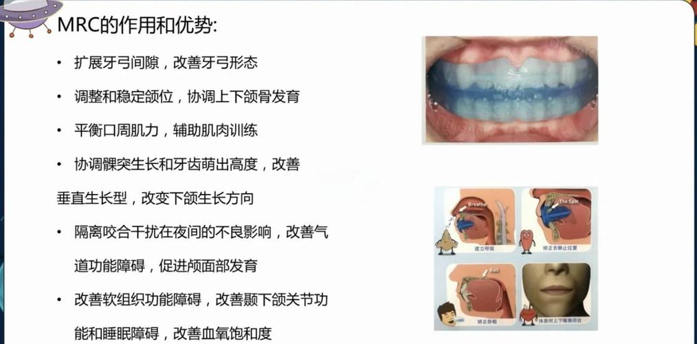 牙齿矫正器构造-图1