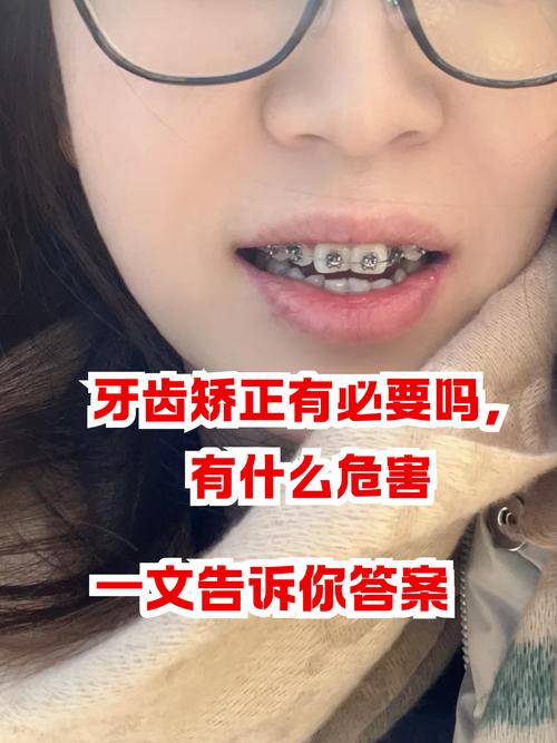 牙齿矫正重要吗-图1