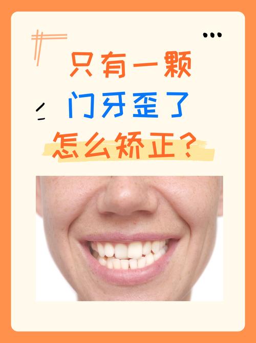 牙齿矫正门牙歪，是矫正器选错还是术后护理没到位？-图2
