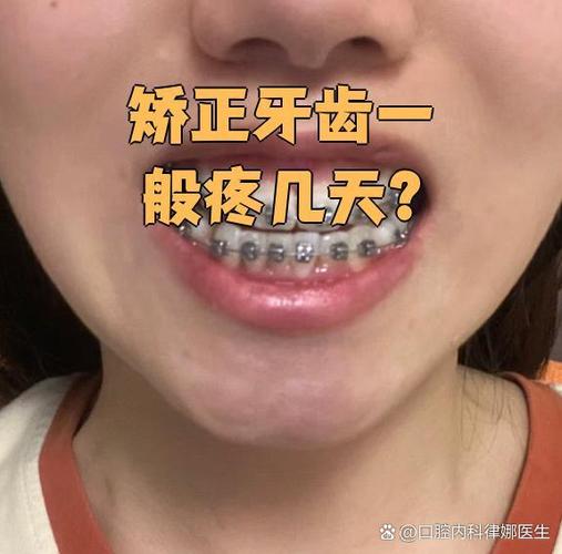 牙齿矫正牵引疼-图3