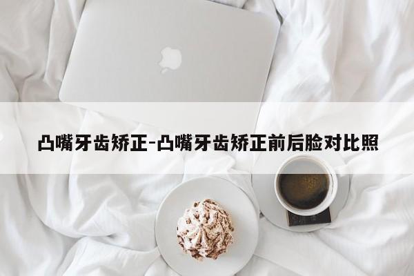 凸嘴牙齿矫正-凸嘴牙齿矫正前后脸对比照-图1