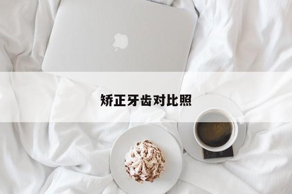 矫正牙齿对比照-图1 矫正牙齿对比照-图1